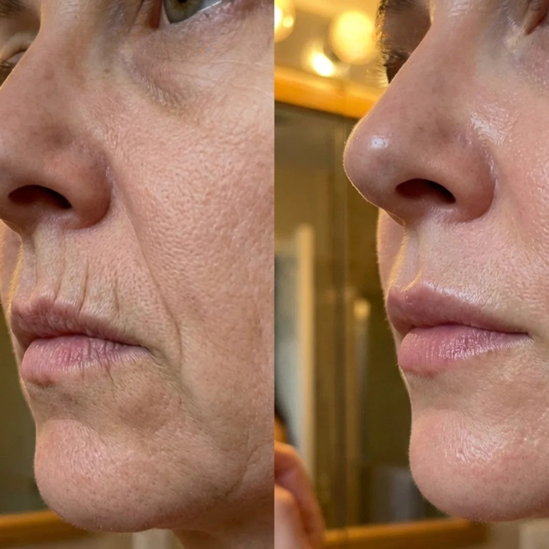 @michelle, 44 — original customer comparison photographs